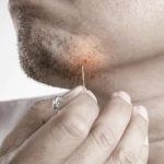 The Ultimate Guide to Managing and Preventing Ingrown Hairs on Your Facial Skin