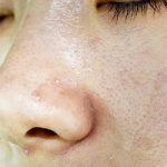 Skincare Tips for Oily Skin: A Comprehensive Guide