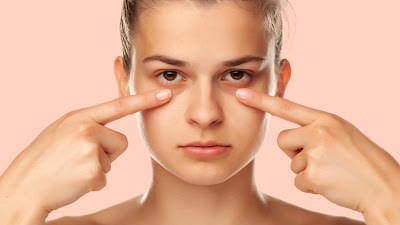 4 Common Ways to Banishing Under-Eye Dark Circles and Puffiness