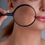 How to Repair a Compromised Skin Barrier