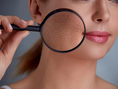 How to Repair a Compromised Skin Barrier