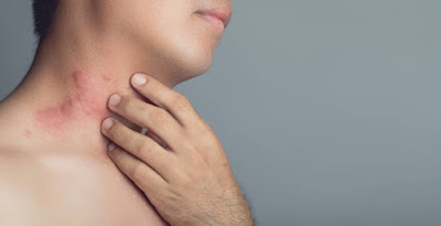 Skin Conditions: Common Issues and Recommended Treatments