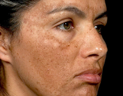 Skin Conditions Recommended Treatments