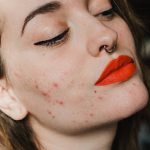 How Hormonal Changes During Menopause Affect the Skin
