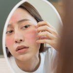 Nurturing Your Sensitive Skin: 10 Sensitive Skincare Considerations