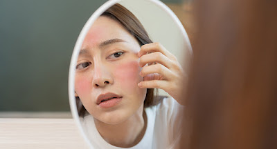 Nurturing Your Sensitive Skin: 10 Sensitive Skincare Considerations