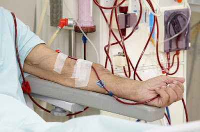 Understanding the Importance of Dialysis Adequacy in CKD