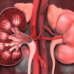 Understanding the Role of Nitric Oxide in CKD