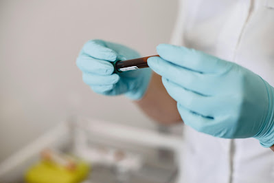 Managing Blood Clots in Diabetic Patients: What to Know