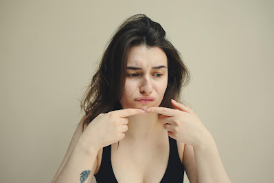 How to Handle Skin Breakouts During Menstruation