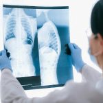 Understanding the Role of Kidney Biopsy in CKD Diagnosis