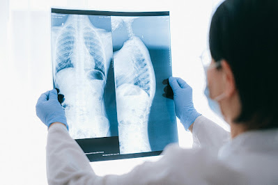 Understanding the Role of Kidney Biopsy in CKD Diagnosis