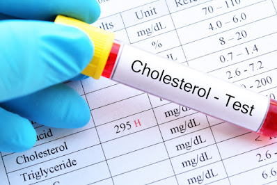 Is Lowering LDL Cholesterol By Diet Helpful?